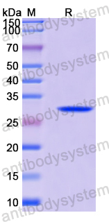 Recombinant Human YWHAH Protein, N-His