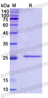 Recombinant Human SRY Protein, N-His