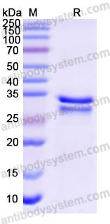 Recombinant Human ICA1 Protein, N-His