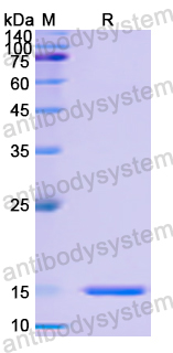 Recombinant Human UBE3A Protein, N-His