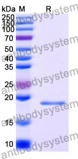 Recombinant Human MXD1 Protein, N-His
