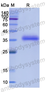 Recombinant Human PTPN12 Protein, N-His