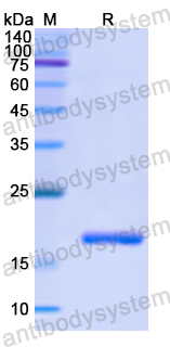 Recombinant Human CLC Protein, N-His