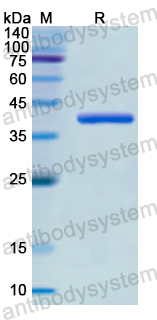Recombinant Human GAD2/GAD65 Protein, N-His