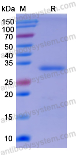 Recombinant Human PTK2 Protein, N-His