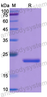 Recombinant Human PRKCZ Protein, N-His