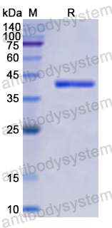 Recombinant Human PRKCD Protein, N-His