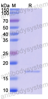 Recombinant Human CALD1 Protein, N-His