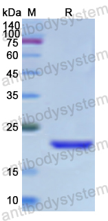 Recombinant Human TYRO3/DTK/SYK Protein, N-His