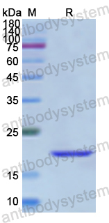 Recombinant Human RAD51 Protein, N-His