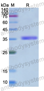 Recombinant Human FMR1 Protein, N-His