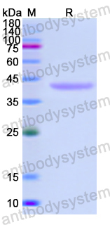 Recombinant Human FMOD Protein, N-His
