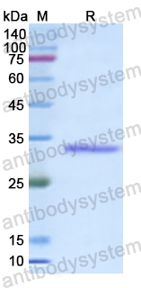 Recombinant Human EGR3 Protein, N-His