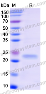 Recombinant Human CD137/TNFRSF9 Protein, N-His