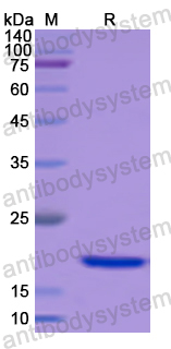 Recombinant Human COL16A1 Protein, N-His