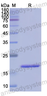 Recombinant Human CD69 Protein, N-His