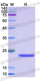 Recombinant Human TJP1 Protein, N-His