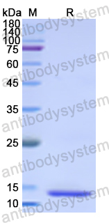 Recombinant Human TCHH Protein, N-His