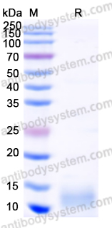 Recombinant Human CXCL9/MIG Protein, N-His