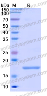 Recombinant Human DPT Protein, N-His