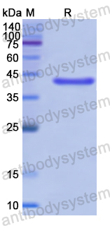 Recombinant Human SPAG1 Protein, N-His