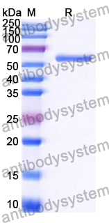 Recombinant Human SOS1 Protein, N-His