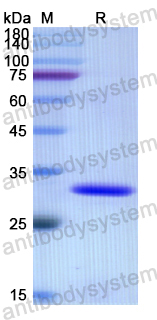 Recombinant Human TNK2 Protein, N-His