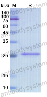 Recombinant Human CYP24A1 Protein, N-His