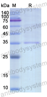 Recombinant Human PPP3CA Protein, N-His