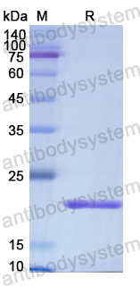 Recombinant Human CDw210b/IL10RB Protein, N-His