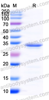 Recombinant Human CD167a/DDR1 Protein, N-His