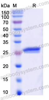 Recombinant Human ADCY2 Protein, N-His