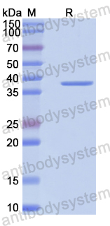 Recombinant Human PDE4C Protein, N-His