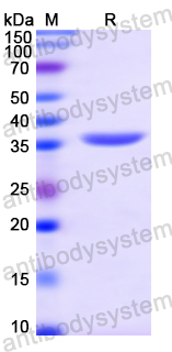 Recombinant Human FGL1 Protein, N-His