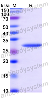 Recombinant Human SLFN5 Protein, N-His