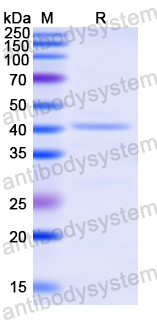 Recombinant Human NSUN2 Protein, N-His