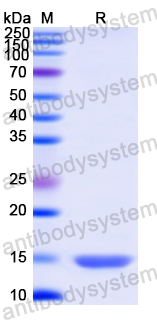 Recombinant Human AHNAK Protein, N-His