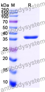 Recombinant Human PLCXD2 Protein, N-His