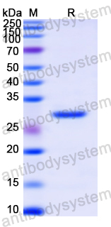 Recombinant Human AP1B1 Protein, N-His