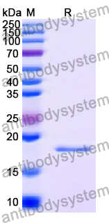 Recombinant Human DBP Protein, N-His