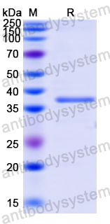 Recombinant Human FUT2 Protein, N-His