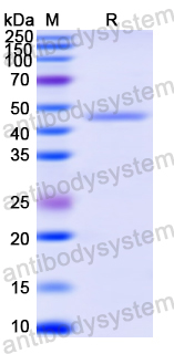 Recombinant Human SCRN1 Protein, N-His