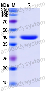 Recombinant Human FOXO1 Protein, N-His