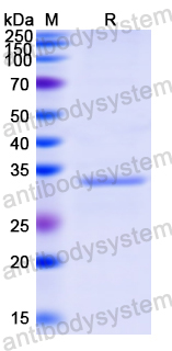 Recombinant Human TWF1 Protein, N-His