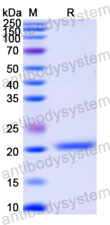 Recombinant Human ASPH Protein, N-His