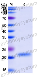 Recombinant Human CETN1 Protein, N-His