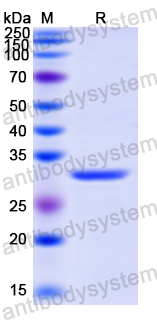 Recombinant Human CDC20 Protein, N-His