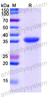 Recombinant Human FSTL1 Protein, N-His