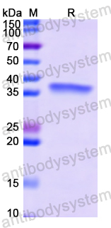 Recombinant Human CDH17 Protein, N-His