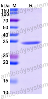 Recombinant Human MERTK Protein, N-His
